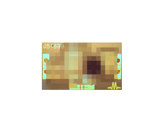 ML1-0113LCH-2